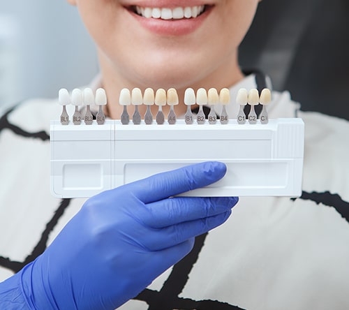 HOW SHOULD I TAKE CARE OF MY COMPOSITE BONDING min